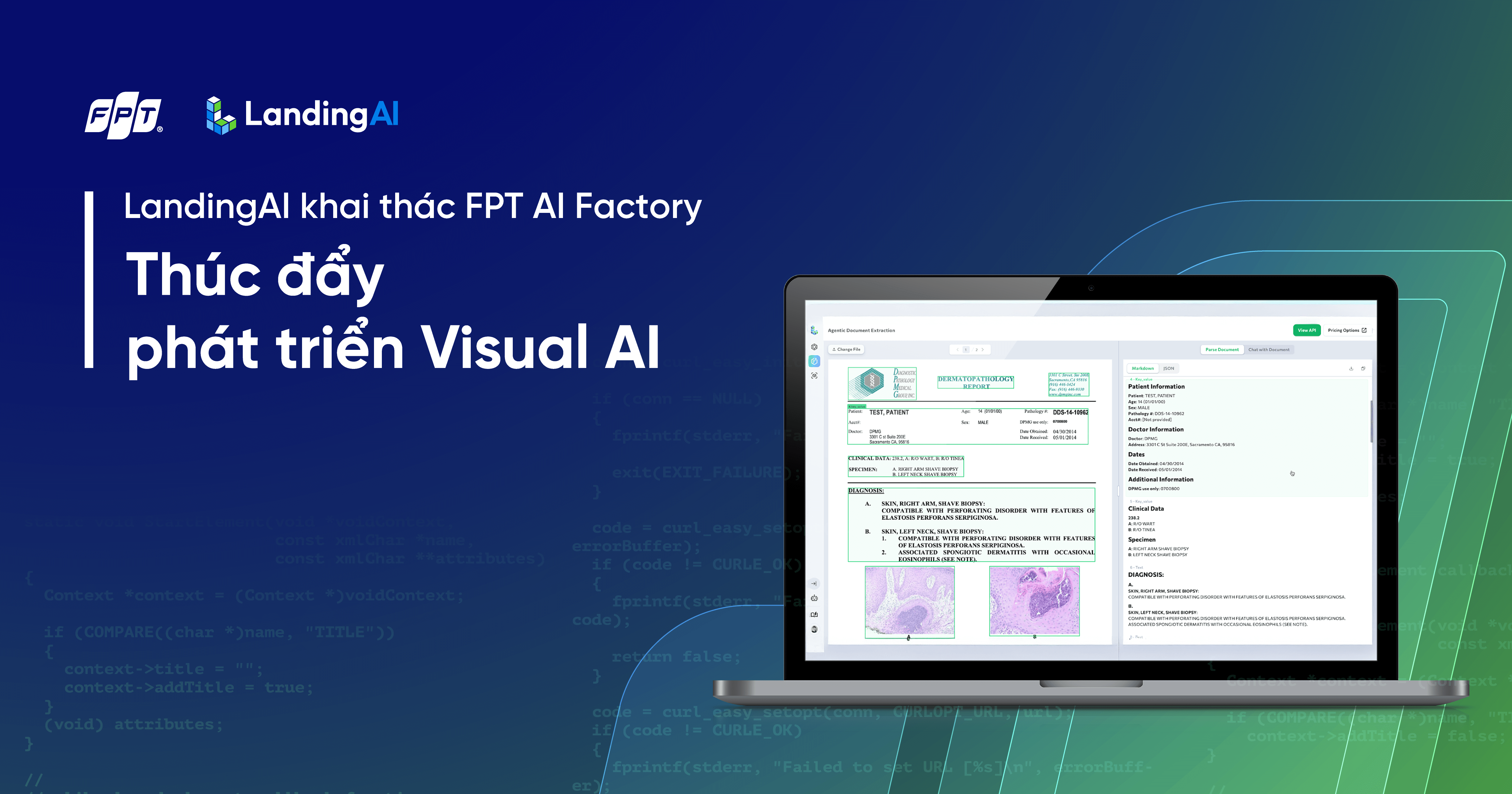 landing AI social post 03 1